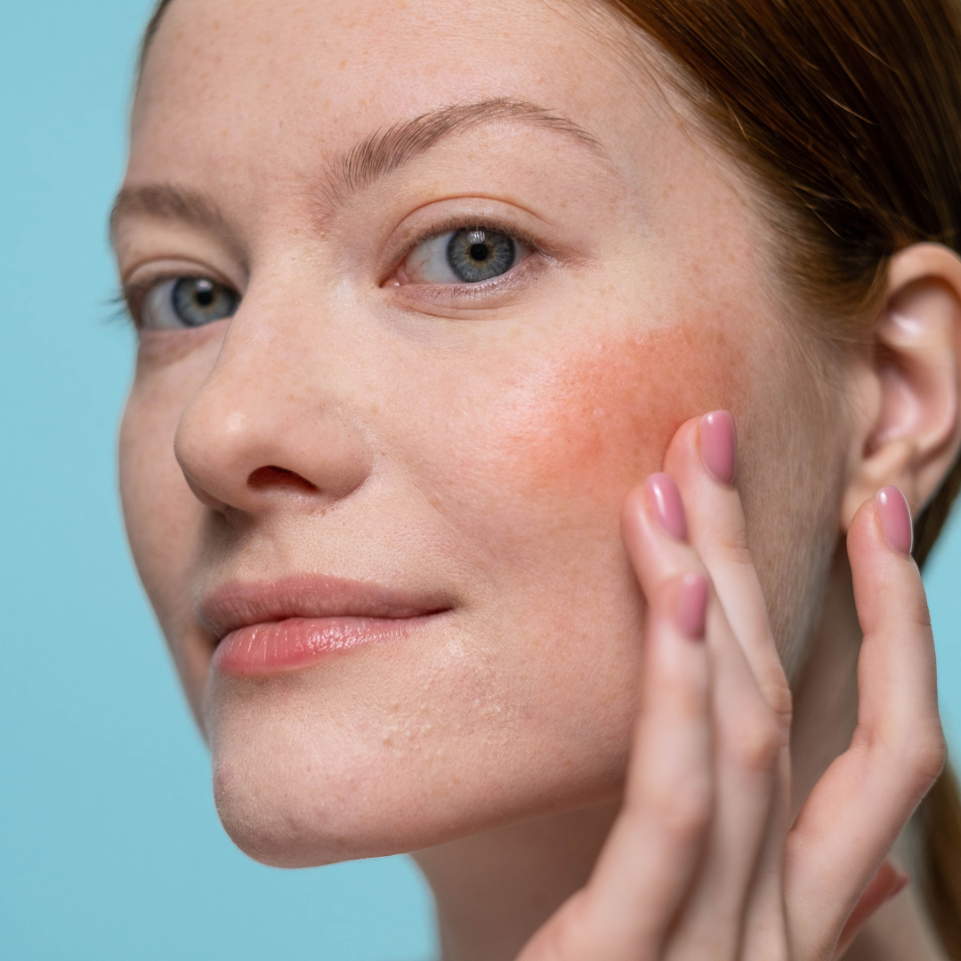 Why is My Skin So Sensitive?